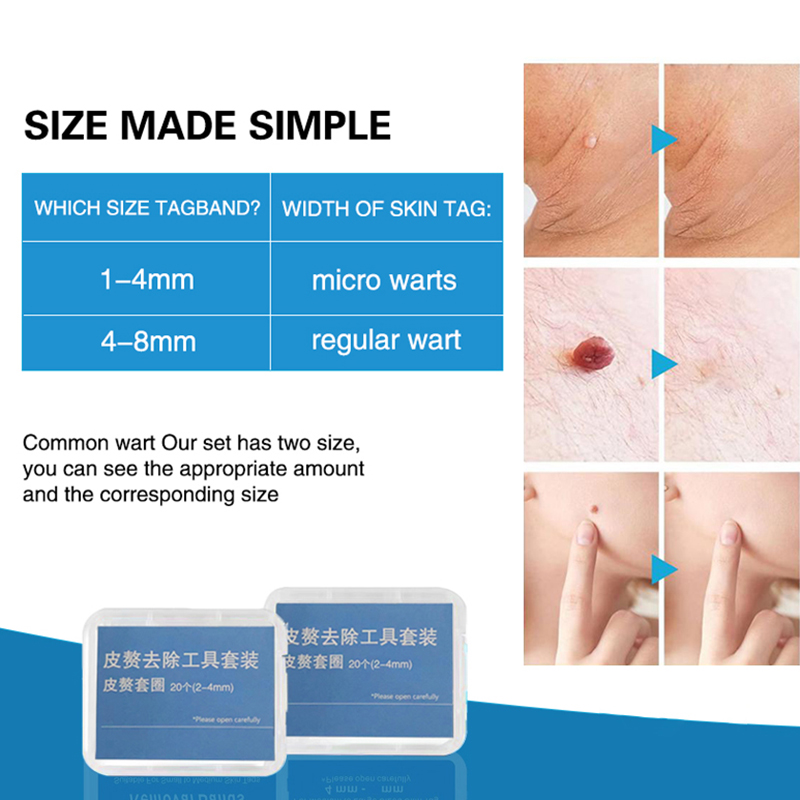 20pcs/Box Flesh Nevus Removal  - Power Tools Usa review and price